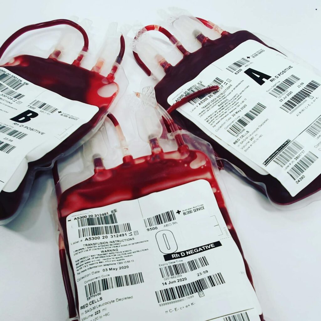 O Hemocentro Regional de Londrina - HU/UEL está pedindo doação de sangue tipo O - tanto o positivo quanto o negativo - para repor os estoques que estão baixos.