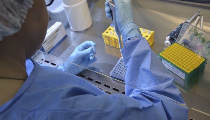 O Laboratório Central de Saúde Pública de Santa Catarina (LACEN) está realizando exames para identificação do novo coronavírus (COVID-19)