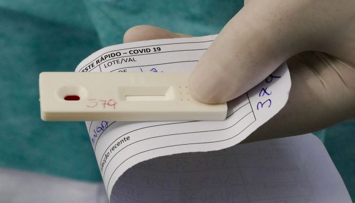 Moradores de Águas Claras enfrentam filas enormes para teste do Covid-19 no estacionamento do Centro Universitário Euroamericano (Unieuro). O 'drive-thru' é feito para testagem em massa do novo coronavírus e o atendimento realiza-se por ordem de chegada, dentro do veículo, sendo proibido sair do carro sem orientação da equipe de saúde. Também é recomendado o uso de máscaras faciais e que cada carro tenha, no máximo, quatro pessoas. Foto: Leopoldo Silva/Agência Senado