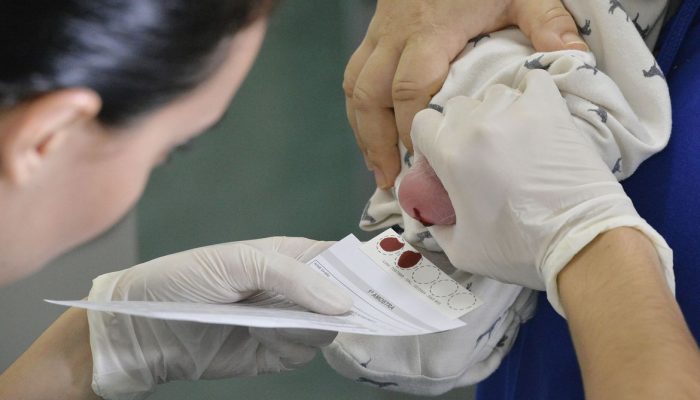 BIE -  Teste do pezinho no Hospital Regional de Taguatinga (HRT).O teste do pezinho, exame feito a partir de sangue coletado do calcanhar do bebê, é uma das principais formas de diagnosticar seis doenças que, quanto mais cedo forem identificadas, melhores são as chances de tratamento. São elas fenilcetonúria, hipotireoidismo congênito, doença falciforme e outras hemoglobinopatias, fibrose cística, deficiência de biotinidase e hiperplasia adrenal congênita.Para realizar o teste do pezinho, a família deve levar o recém-nascido a uma unidade básica de saúde entre o 3° e o 5° dia de vida. É fundamental ter atenção a esse prazo.Foto: Edilson Rodrigues/Agência Senado