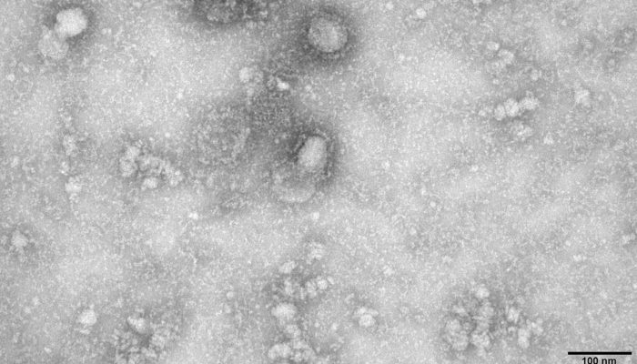 coronavirus-agenciabrasil