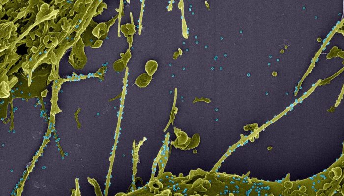 coronavirus_em_acao-fiocruz