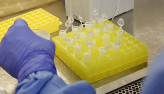 Diagnóstico laboratorial de casos suspeitos do novo coronavírus (2019-nCoV), realizado pelo Laboratório de Vírus Respiratório e do Sarampo do Instituto Oswaldo Cruz (IOC/Fiocruz), que atua como Centro de Referência Nacional em Vírus Respiratórios para o Ministério da Saúde