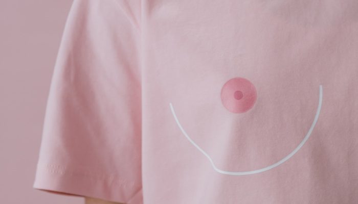 mastectomia-pexels