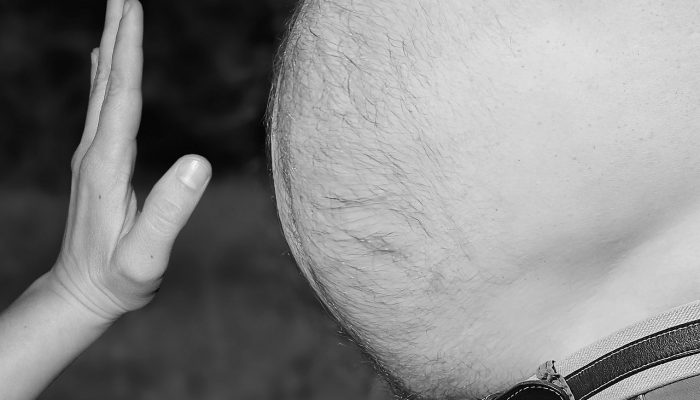 obesity-3247168_1280