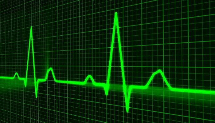 pulse-trace-163708_1280