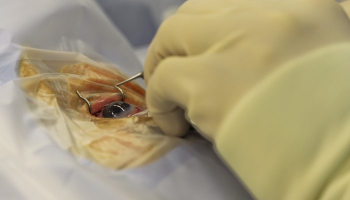 surgery-676388_1920