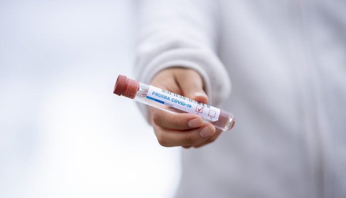 test-tube-5065426_1920