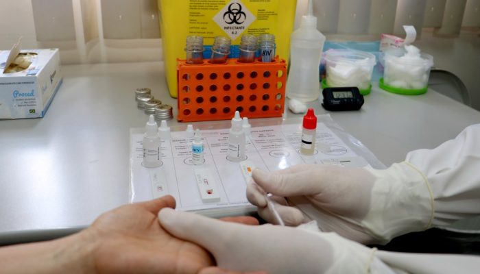 teste-rapido-AIDS-e-outras-doenças-VH-1