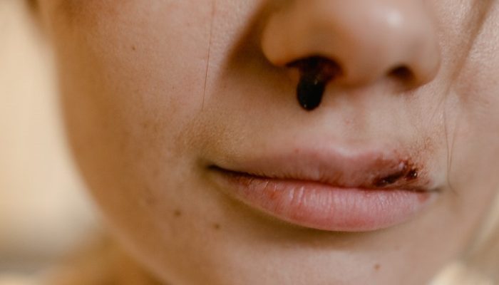 violencia-mulher-pexels
